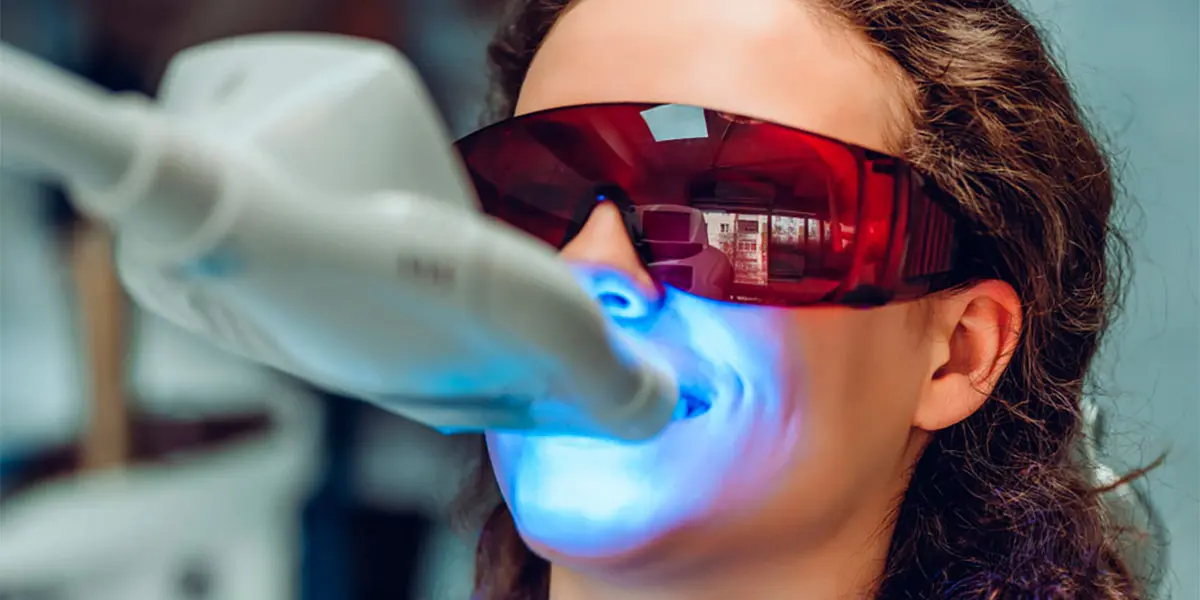 El blanqueamiento dental LED permite mejorar el color de los dientes de forma r&aacute;pida y segura bajo supervisi&oacute;n profesional
