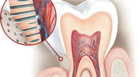 24-Dientes-sensibles-1158.jpg