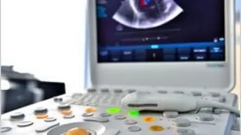 EcografoFOTa1.jpg