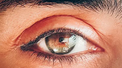 El 12 de marzo es el D&iacute;a Mundial del Glaucoma