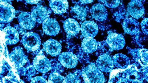 Coronavirus