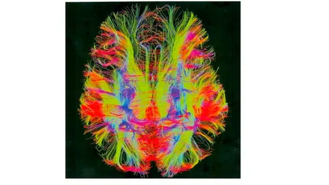 Conferencia en Tudela &lsquo;Medicina art&iacute;stica Arte basado en la observaci&oacute;n patol&oacute;gica y neuropatol&oacute;gica&rsquo;