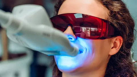 El blanqueamiento dental LED permite mejorar el color de los dientes de forma r&aacute;pida y segura bajo supervisi&oacute;n profesional