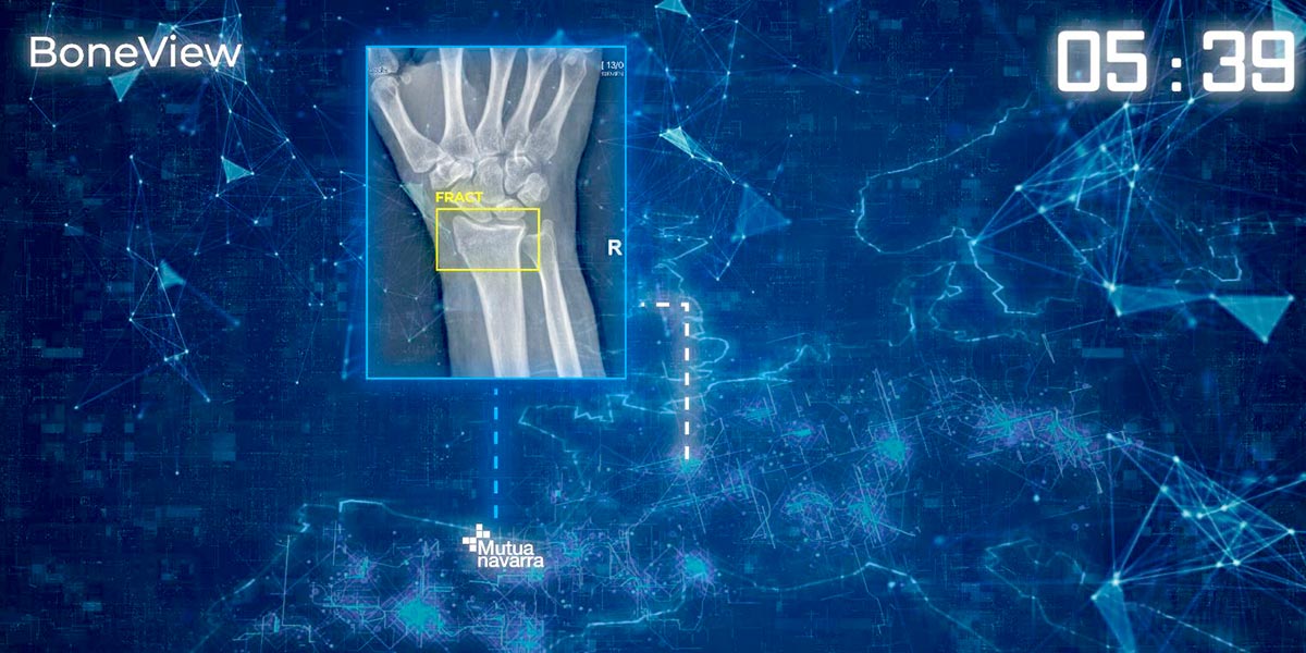 Mutua Navarra Inteligencia Artificial IA