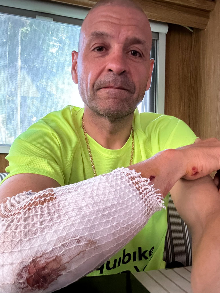 Espada está tomando medicación para la infección e inflamación y espera recuperarse pronto